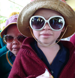 Barn med albinism i Bukoba i Tanzania